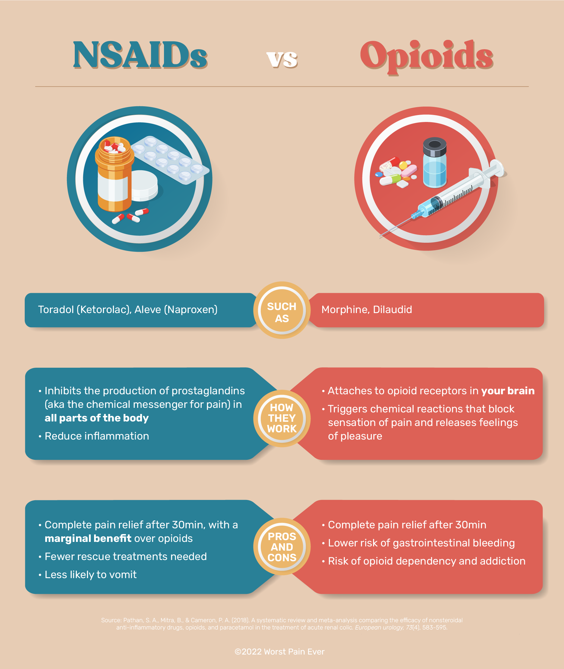 NASIDS for kidney stones pain management